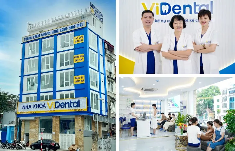 Review Nha Khoa Lê Hưng Đống Đa Có Tốt Không Và Những Lưu Ý Cần Biết