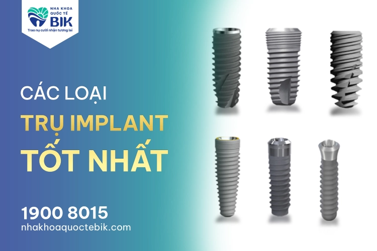 Cấu tạo chi tiết của một bộ Implant bao gồm trụ khớp nối và mão răng sứ