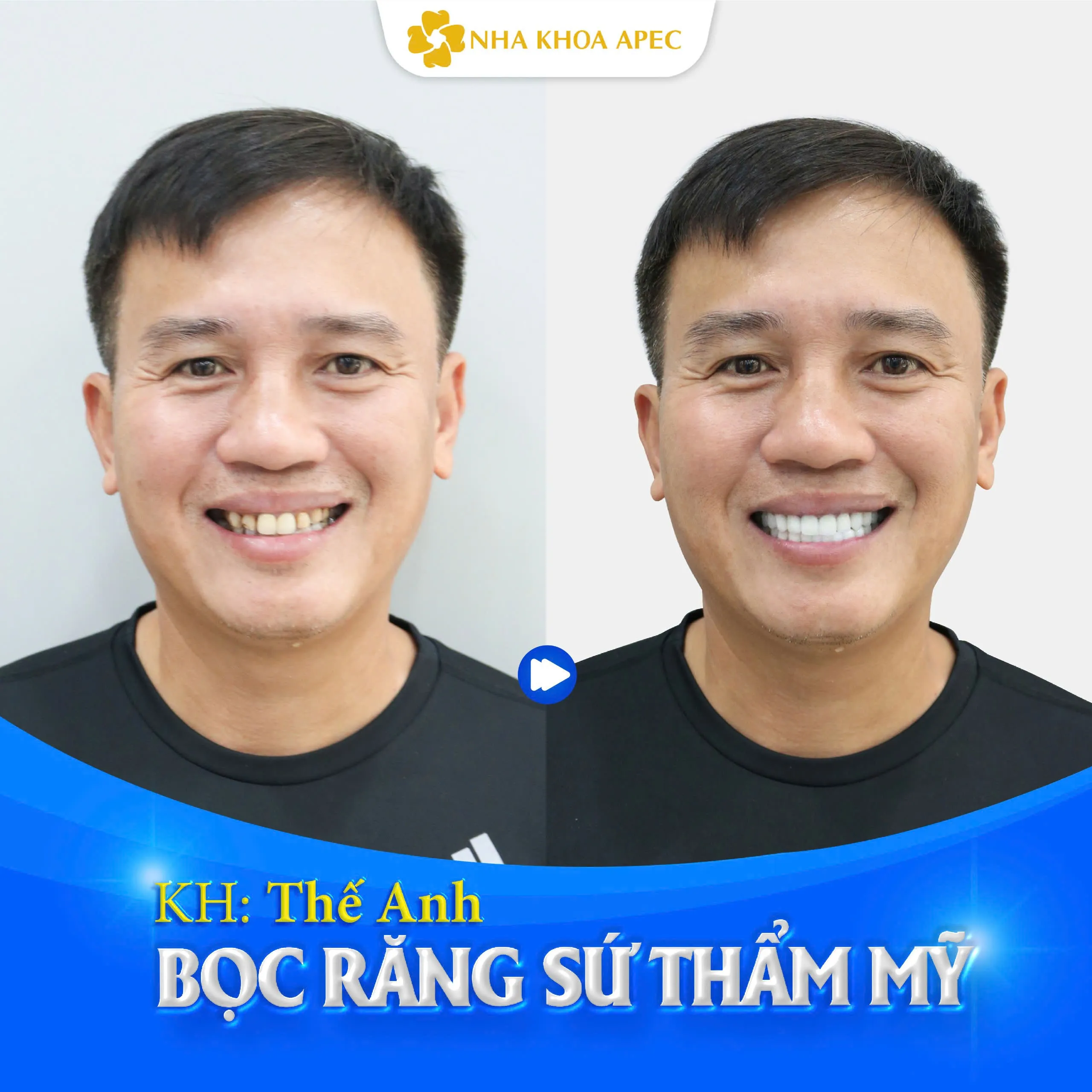 f609f29a5ff4e7aabee5 Sự hài lòng của khách hàng là minh chứng cho chất lượng dịch vụ tại Nha khoa Paris
