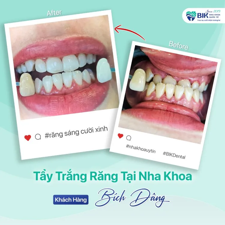 Kết quả ấn tượng mang lại sự tự tin tuyệt đối cho khách hàng