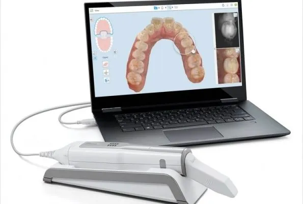 may-scan-itero-595x400-1 Công nghệ iTero 5D giúp lấy dấu răng nhanh chóng và chính xác tại Nha khoa Paris