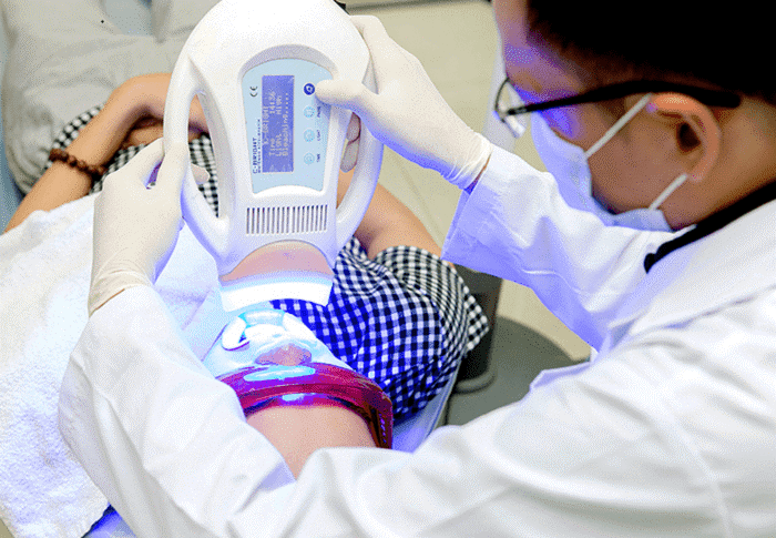 Kỹ thuật chiếu đèn Laser giúp kích hoạt thuốc tẩy trắng một cách nhanh chóng và an toàn