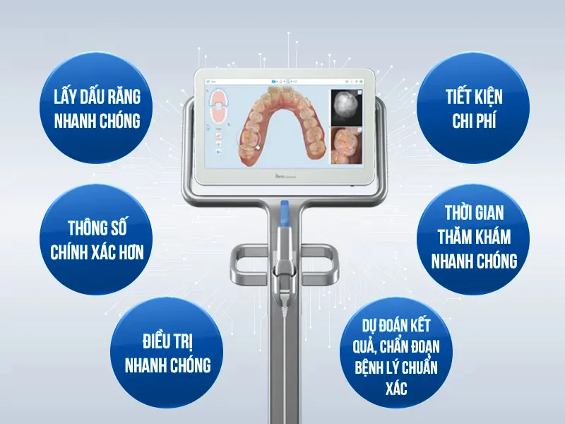 uu-diem-may-quet-dau-ham-itero-5d Công nghệ hiện đại giúp nâng cao hiệu quả và sự thoải mái trong quá trình chỉnh nha